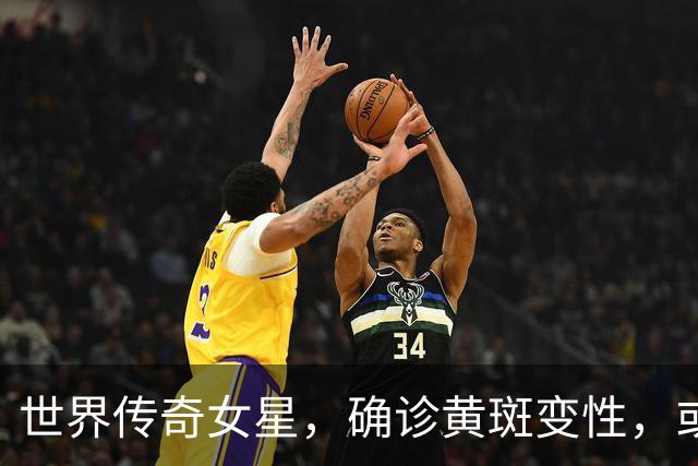 世界传奇女星，确诊黄斑变性，或将告别舞台